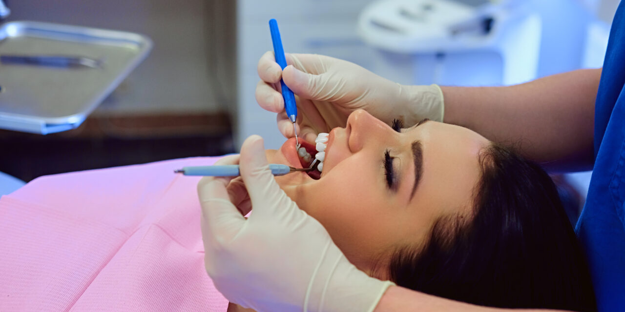 Dental Fillings: Materials, Lifespan, and Replacement