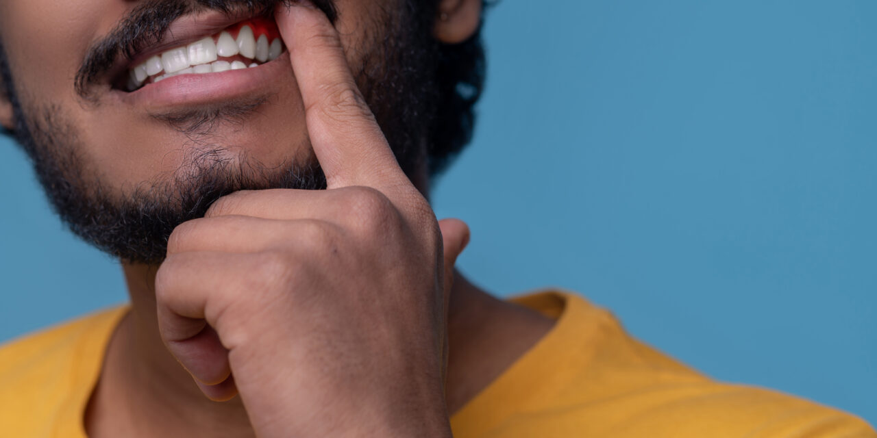 What Happens If a Tooth Abscess Bursts and What You Should Do Next