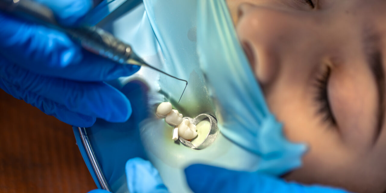 Is It Worth Fixing an Old Dental Crown