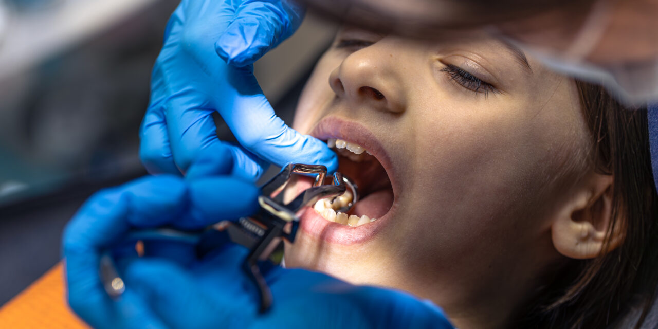 Do You Really Need to Replace Missing Teeth?